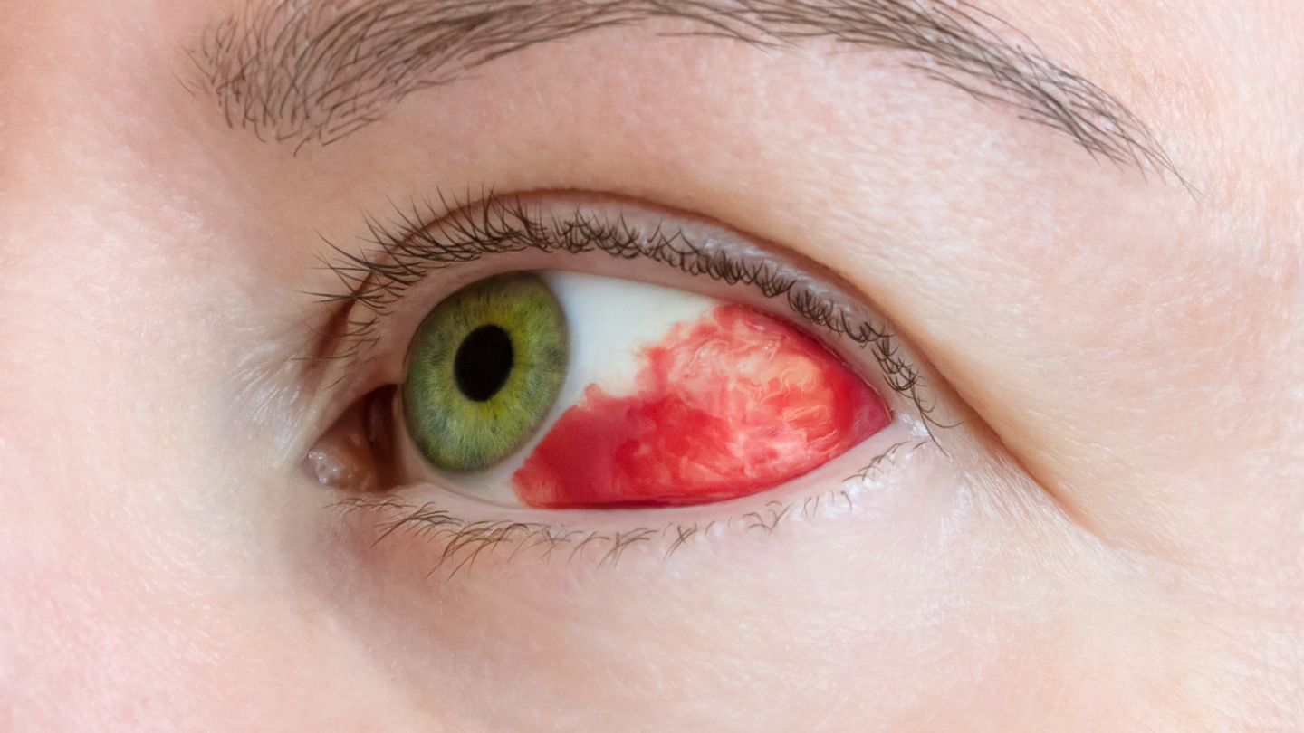 Eye Clinic: Ayzenberg Leonid MD logo